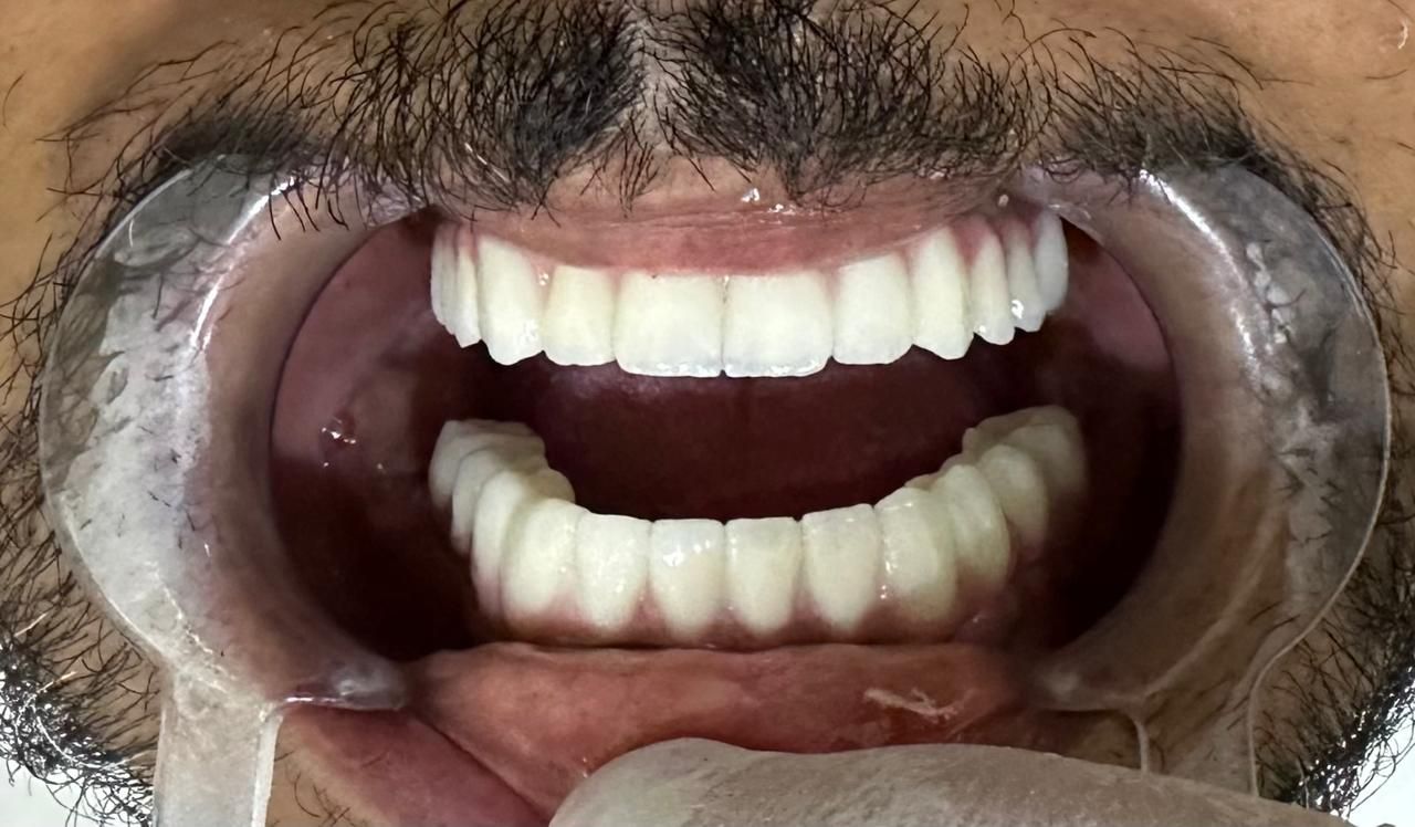 بعد التقويم