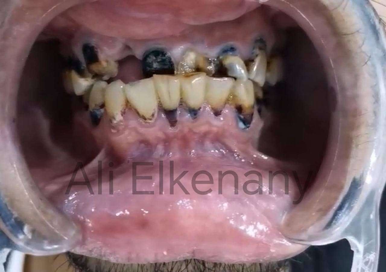 بعد التقويم